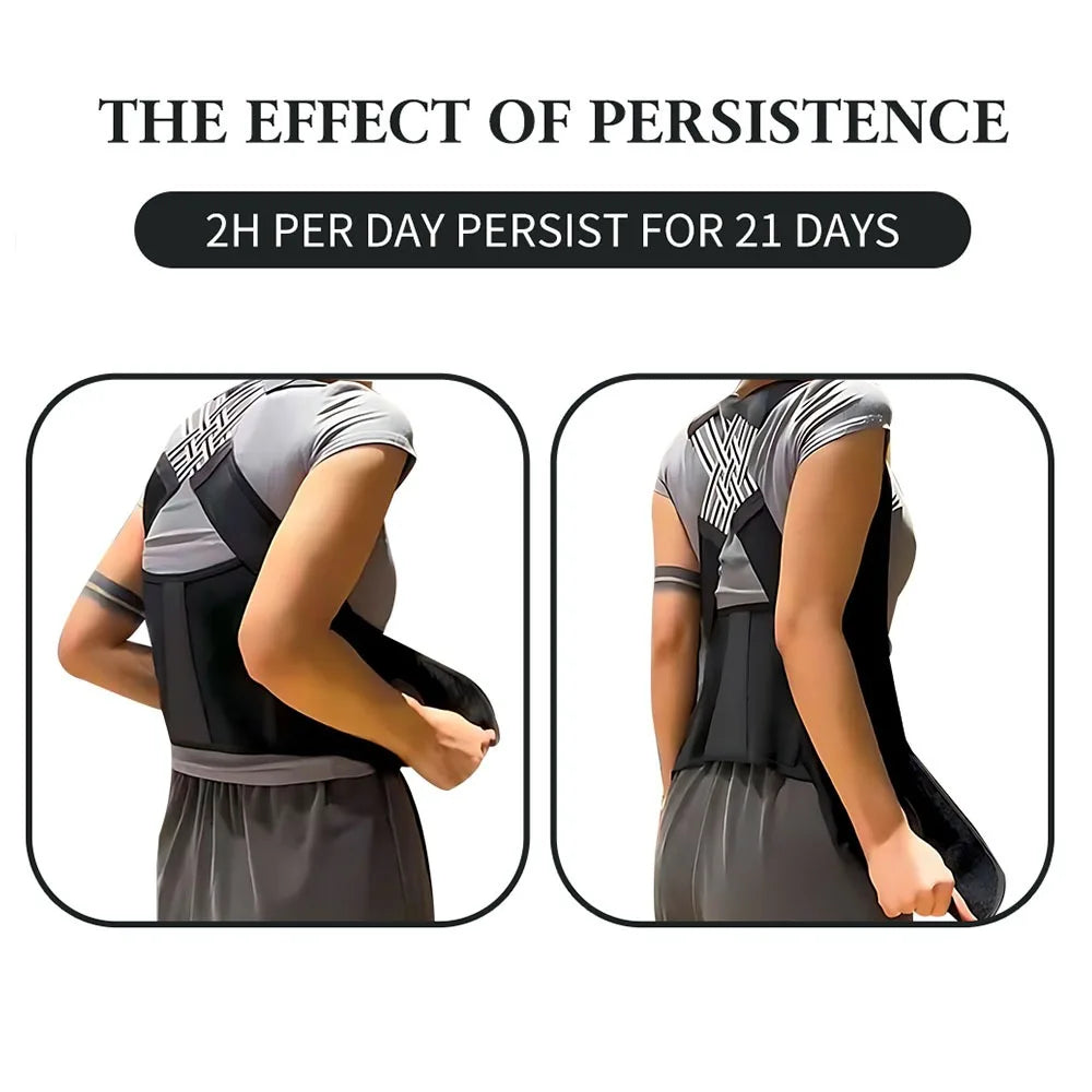 Anti-Hunchback Posture Corrector