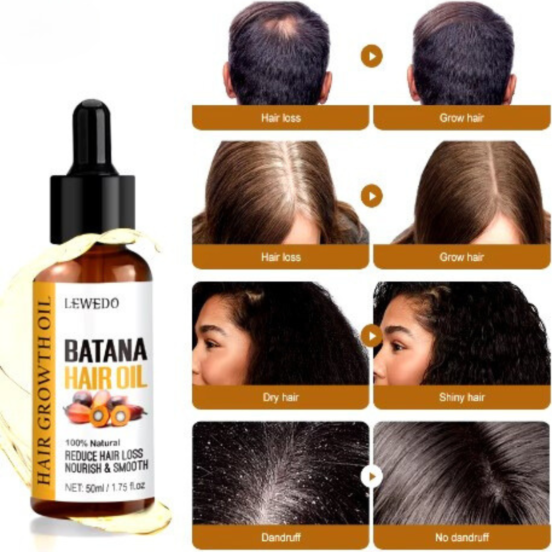 Batana Oil – Natural Hair Treatment for Hair Loss & Anti-Breakage